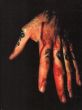 Two Year Autopsy/のサムネール