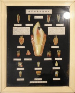 年代不明　歯牙疾患処置標本