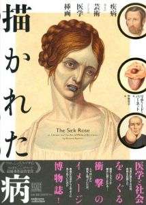 描かれた病　疾病および芸術としての医学挿画/リチャード・バーネット　中里京子訳のサムネール