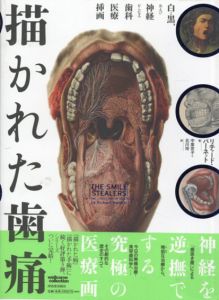 描かれた歯痛　白と黒、および神経からなる歯科医療挿画/リチャード・バーネット　中里京子/北川玲訳